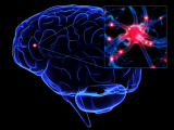 Plasticidad cerebral revierte ictus perinatal