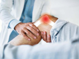 Fasinumab mejora el dolor y funcionalidad en la OA