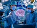 Resección temprana de gliomas eleva la sobrevida 