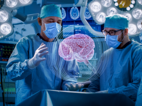 Resección temprana de gliomas eleva la sobrevida 