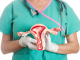 Elagolix y terapia hormonal atenúan la menorragia 