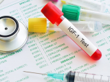 IGF-1, predictor de cáncer colorrectal