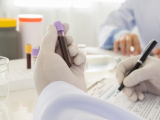 Evolocumab regula perfil lipídico en pacientes con VIH