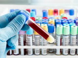 Grupo sanguíneo, clave en severidad de infección