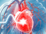 Inhibidores de PCSK9, reductores del riesgo CV