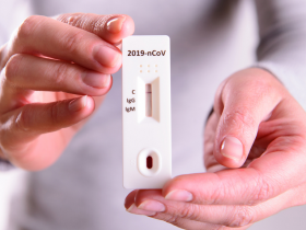 SARS-CoV-2 tiene una baja seropositividad