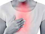 Reflujo gastroesofágico y fibrosis pulmonar idiopática