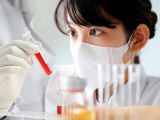 PTX3 como biomarcador del adenocarcinoma ductal de páncreas