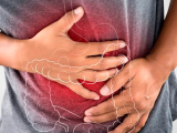 Inhibidor de la transglutaminasa 2 para la enfermedad celíaca