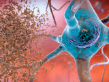 El colesterol cerebral regula las placas del alzhéimer