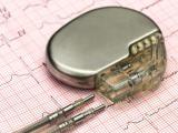 Implantes pueden cambiar las reglas del juego en pacientes cardíacos  