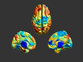 Cerebro tiene su propia 