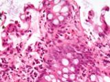 Cómo nuestro microbioma intestinal se comunica con el sistema inmune