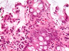 Cómo nuestro microbioma intestinal se comunica con el sistema inmune