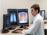 Rayos X de campo oscuro mejoran el diagnóstico de dolencias pulmonares
