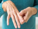 Biomarcadores predictores de artritis reumatoide 