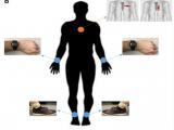 Biosensores portátiles para personas con problemas de salud complejos 
