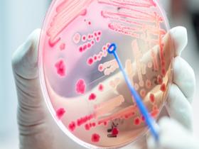 Suplemento alimentario propende la regulación de glucosa 