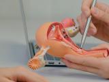 Exceso de peso casi duplica el riesgo de cáncer de útero