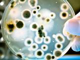 Impacto de la microbiota oral y de la piel en la hipertensión 