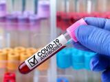 Tratamiento con anticuerpos monoclonales muestra bajas tasas de enfermedad grave 