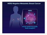 Trastuzumab deruxtecan muestra eficacia en cáncer de mama 