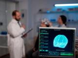 Efectos del fentanilo en el cerebro 