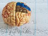 Ayuno reduce convulsiones en epilepsia 