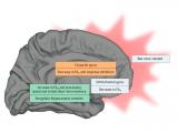 Estrés relacionado a la guerra provoca cambios en la microestructura del cerebro