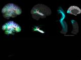 Conectividad en el eje anteroposterior del hipocampo medido in vivo 