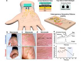 Tatuaje electrónico en la palma de la mano detecta el estrés