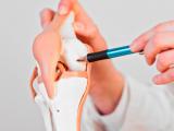 Metformina reduce significativamente el riesgo de prótesis articular 