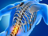 Intervención Biopsicosocial en pacientes con dolor vertebral agudo y subagudo