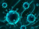 Características mecánicas críticas del ensamblaje de la cápside viral del VIH