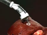Bioimpresión en 3D dentro del cuerpo humano 