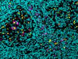 Cambio molecular en un anticuerpo acelera respuesta inmunitaria contra el cáncer