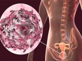 Microbioma vaginal de la madre no influye en el microbioma intestinal del bebé
