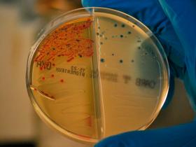 Consumo y resistencia a antibióticos es una 