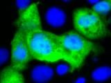 Anticuerpos neutralizantes mucosos y sistémicos contra norovirus