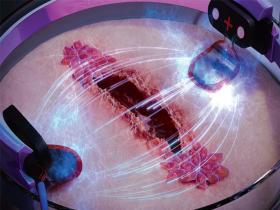 Cicatrización de heridas mediante microfluidos bioelectrónicos