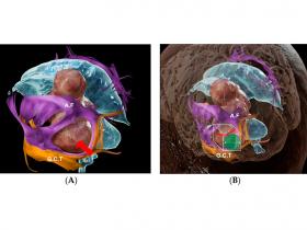 Abordaje tubular parafascicular para la resección de tumores cerebrales en áreas elocuentes
