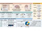 Glioblastoma secuestra redes neuronales con trombospondina-1