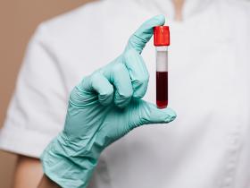 Inflamación inducida por la obesidad exacerba la hematopoyesis clonal