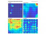 Deep learning para el análisis de electrocardiogramas 