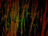 Ultrasonidos biodegradables abren la barrera hematoencefálica
