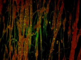 Ultrasonidos biodegradables abren la barrera hematoencefálica