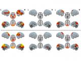 Modelado cerebral identifica circuitos implicados en la conciencia