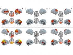 Modelado cerebral identifica circuitos implicados en la conciencia