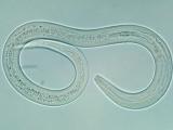 Anquilostomiasis controlada para el mantenimiento en pacientes con colitis ulcerosa