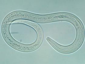 Anquilostomiasis controlada para el mantenimiento en pacientes con colitis ulcerosa